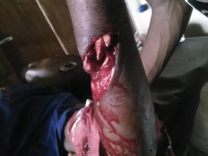 EEDC Staff Gruesomely Attacked In Abia (Graphic Picture) 1