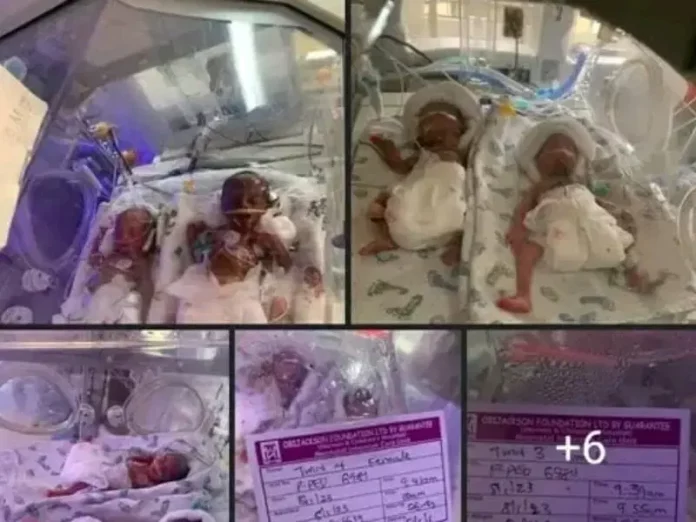 UNIZIK Lecturer, Unpaid For 2 Years Gives Birth To 7 Babies
